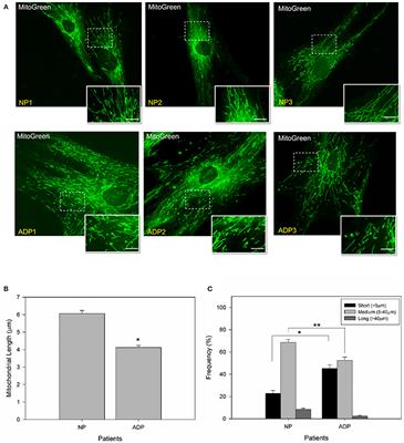 Mitochondrial Bioenergetics Is Altered in Fibroblasts from Patients with Sporadic Alzheimer's Disease